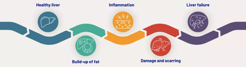 Liver health image